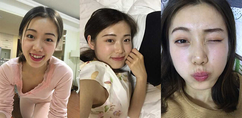 【某某門事件】第423彈 湖南❤️韓亞超❤️情侶私拍洩密 出軌懷孕奉子成婚 口交內射視頻被綠帽男憤怒曝出